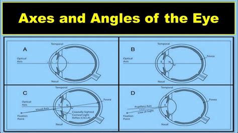 david clulow what does axis mean on eye test
